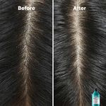 L'Oréal Professionnel Serie Expert Scalp Advanced Anti-Dandruff Dermo Clarifier Shampoo 300ml