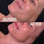 Skintruth Nourishing Facial Kit for Normal & Dry Skin