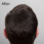 Sibel Hair Sculptor Hair Building Fibers - Dark Brown 25g