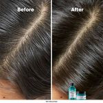 L'Oréal Professionnel Serie Expert Scalp Advanced Anti-Oiliness Dermo Purifier Shampoo 300ml