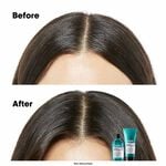 L'Oréal Professionnel Serie Expert Scalp Advanced Anti-Discomfort Dermo Regulator Shampoo 300ml