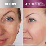 Retinol Anti-Aging Gel Cleanser 120ml