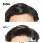 L'Oréal Professionnel Serie Expert Scalp Advanced Anti-Oiliness 2-in-1 Deep Purifier Clay Mask 250ml