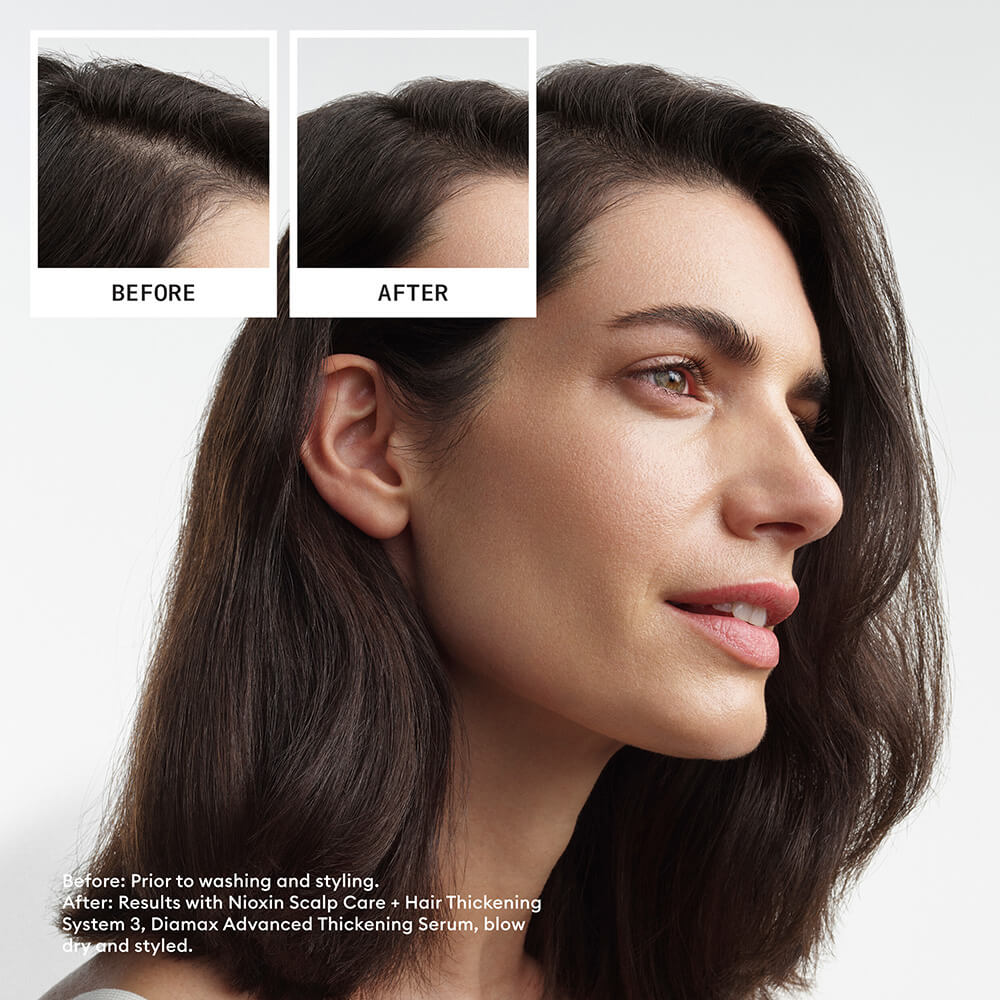 Nioxin System Trial Kit 3 before and after image