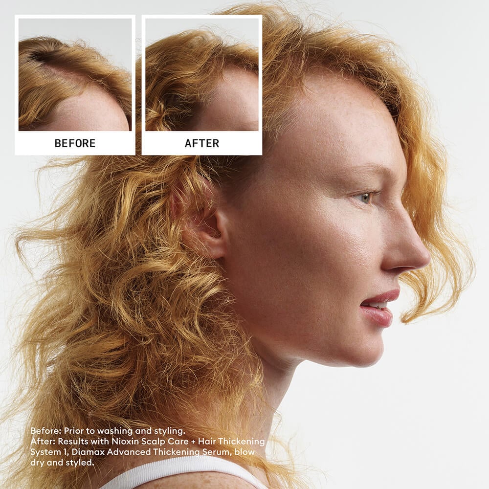Nioxin System Trial Kit 1 before and after image