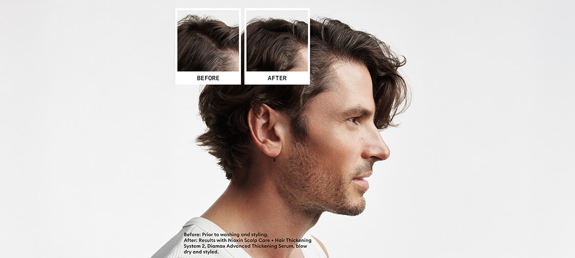 Nioxin System Kit 2 before and after image
