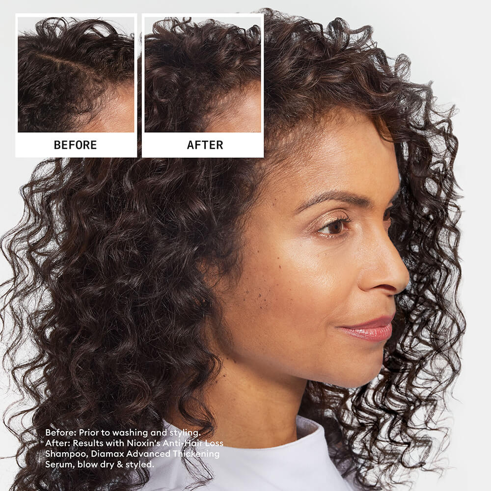 Nioxin Anti-Hair Loss Shampoo before and after image